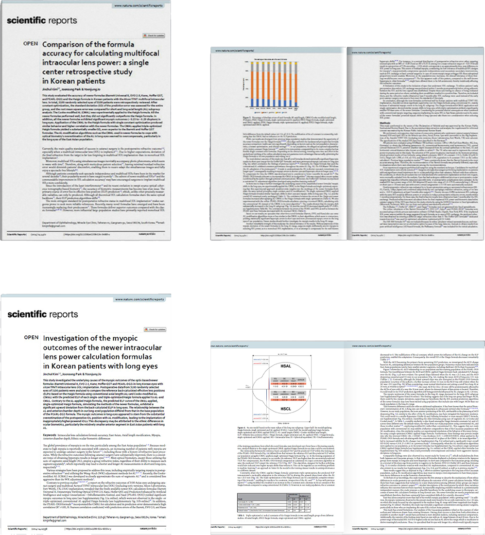 Cataract Surgery and Lens Implant in Korea Samsung Miracle eye clinic seoul