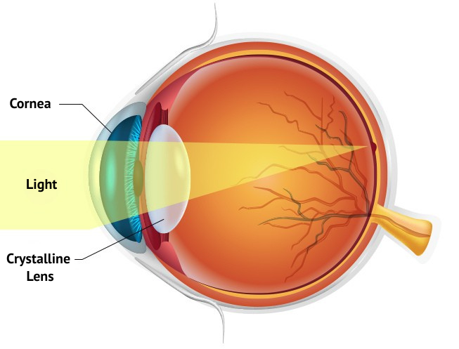 Cataract Surgery and Lens Implant in Korea Samsung Miracle eye clinic seoul