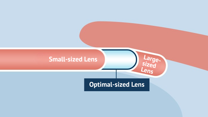 lens implantation research in korea Samsung Miracle eye clinic seoul