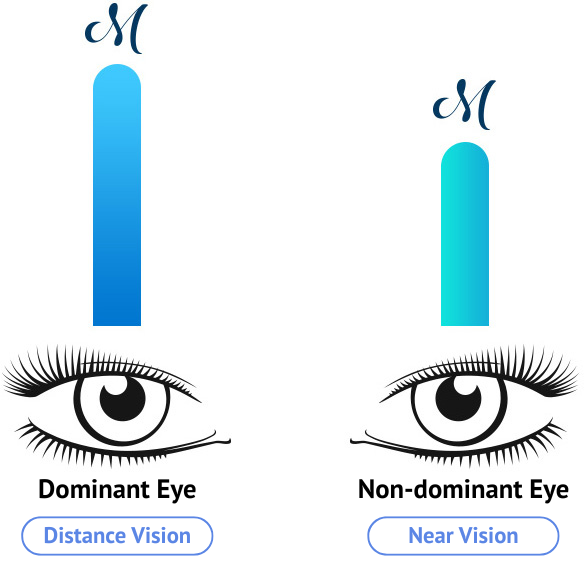 LASIK for Presbyopia in Korea samsung miracle eye clinic in seoul
