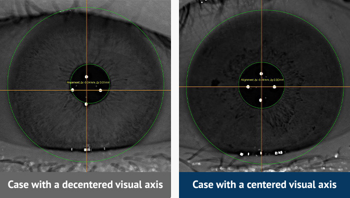 Samsung Miracle eye clinic in korea seoul