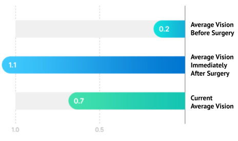 smile laser eye surgery research in Korea Samsung Miracle eye clinic seoul