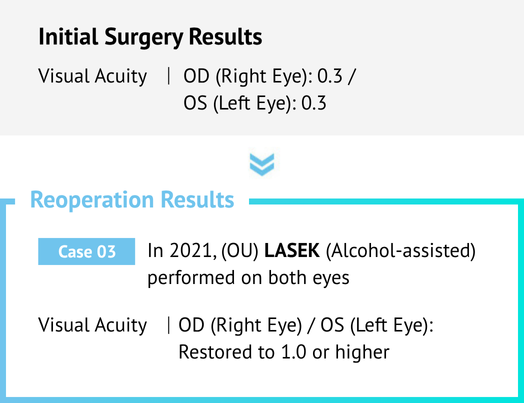 Vision Correction Revision Surgery in Korea Samsung Miracle eye clinic seoul
