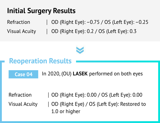 Vision Correction Revision Surgery in Korea Samsung Miracle eye clinic seoul