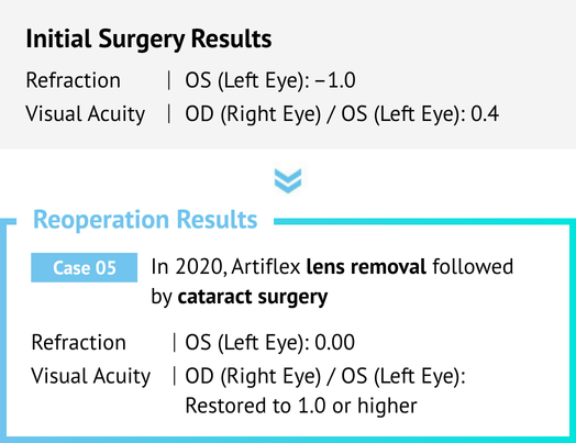 Vision Correction Revision Surgery in Korea Samsung Miracle eye clinic seoul