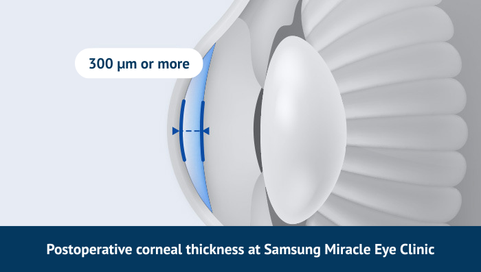 Samsung Miracle eye clinic in korea seoul
