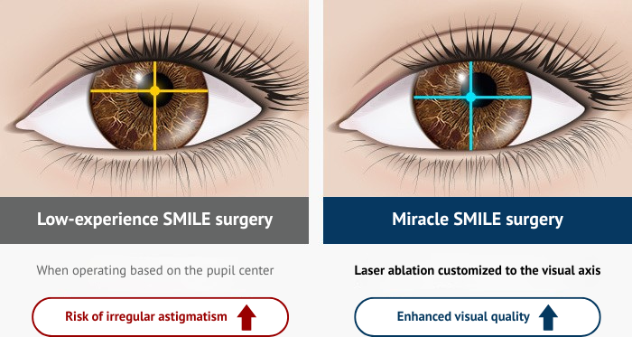 Samsung Miracle eye clinic in korea seoul