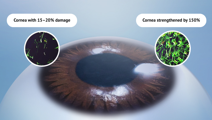 Samsung Miracle eye clinic in korea seoul