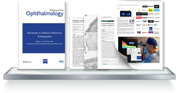 smile laser eye surgery research in Korea Samsung Miracle eye clinic seoul